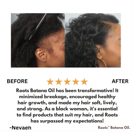 Roots™ Batana Natural Hair Growth Oil