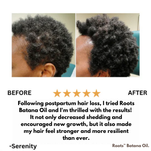 Roots™ Batana Natural Hair Growth Oil