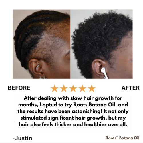 Roots™ Batana Natural Hair Growth Oil